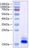 Active Recombinant Human TNFRSF10B/DR5/TRAIL-R2 Protein (RP00282)