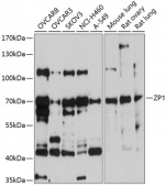 ZP1 Rabbit pAb (A10776)