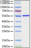 Recombinant SARS-CoV Nucleocapsid Protein (RP01296LQ)