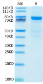 Recombinant Human IL-3RA/CD123 Protein (RP02401)