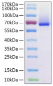 Active Recombinant Human Glypican-1/GPC1 Protein (RP00297)