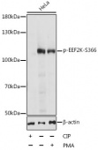 Phospho-EEF2K-S366 Antibody kit (RK05745)