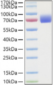 Active Recombinant Human IFNAR2 Protein (RP01342)