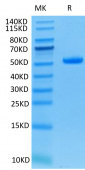 Recombinant Human TNFSF9/4-1BB Ligand Trimer Protein (RP02283)