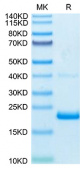 Recombinant Human TNF-alpha Protein (RP02081)