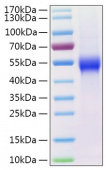 Recombinant Human uPAR/PLAUR/CD87 Protein (RP00295)