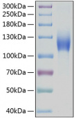 Active Recombinant Human c-Kit/CD117 Protein (RP00114)