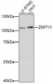 ZNF711 Rabbit pAb (A17008)