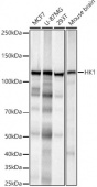 [KO Validated] HK1 Rabbit mAb (A23524)