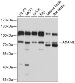 ADAM2 Rabbit pAb (A10188)