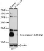 [KO Validated] Peroxiredoxin 2 (PRDX2) Rabbit pAb (A1919)