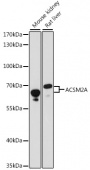 ACSM2A Rabbit pAb (A15563)