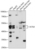 ACTL8 Rabbit pAb (A14937)
