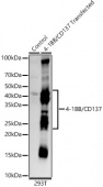4-1BB/CD137 Rabbit mAb (A22167)