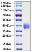 Active Recombinant Human B7-H3/CD276 Protein (RP01020)