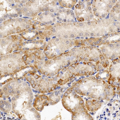 Anti -ACSS1 Rabbit pAb