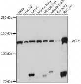 ACLY Rabbit mAb (A3719)