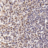 Anti - SIRT1 Rabbit pAb