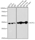 ACTC1 Rabbit pAb (A6507)