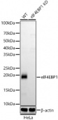 [KD Validated] eIF4EBP1 Rabbit mAb (A23500)