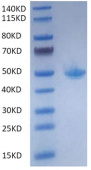 Recombinant Mouse FcRn Protein (RP02030)