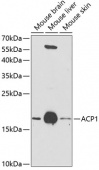 ACP1 Rabbit pAb (A1801)