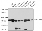 ADAM19 Rabbit pAb (A10260)