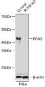 [KO Validated] PON2 Rabbit pAb (A19852)