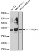 14-3-3 sigma Rabbit mAb (A4377)