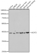 ACAT2 Rabbit mAb (A1399)