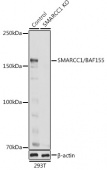 [KO Validated] SMARCC1/BAF155 Rabbit pAb (A6128)