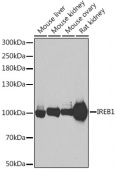 Aconitase 1 (ACO1) Rabbit pAb (A6008)