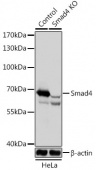 [KO Validated] Smad4 Rabbit pAb (A18078)