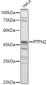 [KO Validated] PTPN2 Rabbit pAb (A1808)