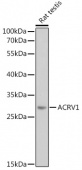 ACRV1 Rabbit pAb (A8098)