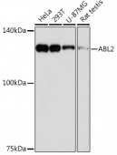 ABL2 Rabbit mAb (A19628)