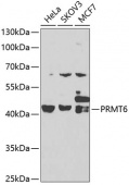 [KO Validated] PRMT6 Rabbit pAb (A7814)