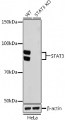 [KO/KD Validated] STAT3 Rabbit mAb (A22424)