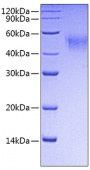 Recombinant Mouse Fc-gamma RI/CD64 Protein (RP00710)