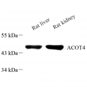 Anti -Acyl-coenzyme A Thioesterase 4 Rabbit pAb