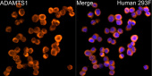 ADAMTS1 Rabbit mAb (A23840)