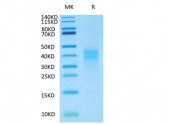 Biotinylated Recombinant Human IL-13 Protein (RP02394)