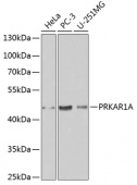 [KO Validated] PRKAR1A Rabbit pAb (A0906)