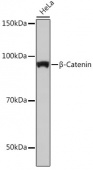 [KO Validated] β-Catenin Rabbit mAb (A19657)