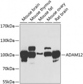 ADAM12 Rabbit pAb (A7940)