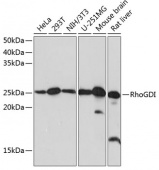 [KO Validated] RhoGDI Rabbit mAb (A11556)