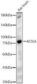 ACSL6 Rabbit pAb (A7965)