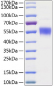 Active Recombinant Human BTLA Protein (RP01052)