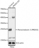 [KO Validated] Peroxiredoxin 3 (PRDX3) Rabbit pAb (A18022)