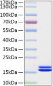 Active Recombinant Human IL-2 Protein (RP01039)